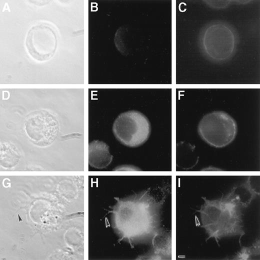 Fig. 2. Morphologic effects of LSP1 on MI-U937 cells depend on the level of LSP1 expression. / MI-U937− (panels A, B, and C), MI-U937+, (panels D, E, and F), and MI-U937++++(panels G, H, and I) were stained with anti-LSP1 primary antibody with Oregon Green conjugated second antibody and with Texas Red phalloidin for F-actin. Photomicrographs shown are the phase-contrast images (panels A, D, and G), the LSP1 images (panels B, E, and H), and the F-actin images (C, F, and I) of the same cells. Note surface projections with LSP1 and F-actin (arrowhead) in MI-U937++++ cells, but not MI-U937+. The bar is 2 μm.