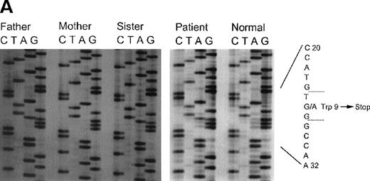 Fig. 2. Sequence analysis of exon 1 and 2 in patient 5. / Panel A: Sequence analysis of exon 1 of the CYBA gene of patient 5 and his family members. The patient, his father, and sister are all heterozygous for A at nucleotide 26, producing a nonsense codon at amino acid 9. The normal control shows only G at position 26. Panel B: Sequence analysis of exon 2 of the CYBA gene of patient 5 and his family members. The patient is homozygous for T at nucleotide 74, causing the replacement of glycine 25 with valine. The patient's mother is heterozygous as seen by the presence of both G and T at position 74. The patient's father and sister do not carry this allele as seen by the appearance of only the G at this position.