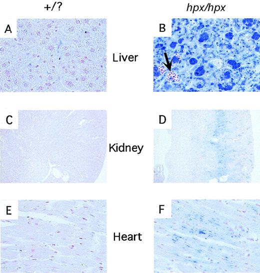 Fig. 4. Iron deposition in tissues from wild-type andTrfhpx/hpx mice. / Histologic sections were stained with the Perl's stain for iron. Panels A, C, and E are sections of liver, kidney, and heart (respectively) from nonanemic mice (Trfhpx/+ orTrf+/+ genotype). Panels B, D, and F are sections of liver, kidney, and heart fromTrfhpx/hpx mice. Iron deposits stain blue. The arrow in panel B highlights an area of extramedullary hematopoiesis within the liver of the mutant animal.