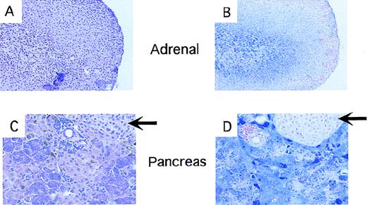 Fig. 5. Iron deposition in endocrine tissues fromTrfhpx/hpx mice. / All panels show tissues fromTrfhpx/hpx mice last treated with Trf 7 to 8 months earlier. Panels A and C are stained with hematoxylin and eosin; panels B and D are stained with the Perl's stain for iron. Panels A and B show adrenal tissue; panels C and D show pancreas. Iron deposits stain blue. Arrows indicate pancreatic islets.