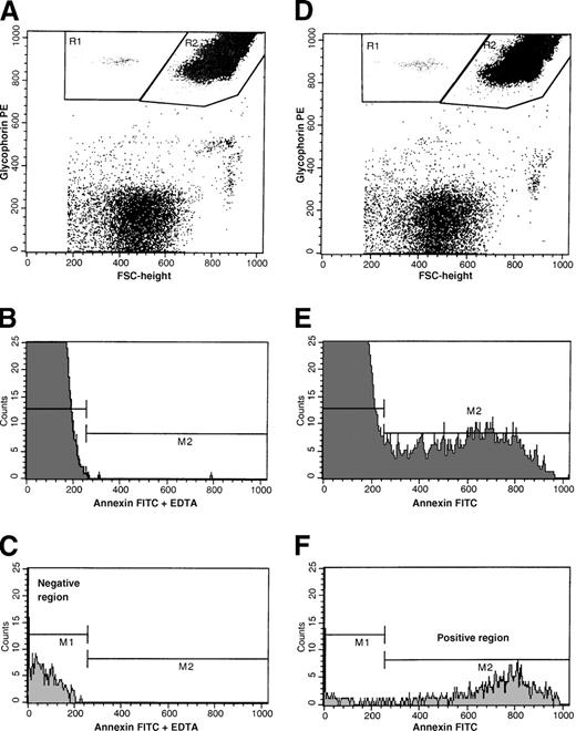 Fig. 1. Flow cytometric analyses of a whole blood sample from a representative patient with SCD stained with annexin V–FITC and glycophorin-A PE in the presence of either calcium or EDTA. / (A) Dot plot of forward size scatter versus glycophorin-A–PE fluorescence stained in the presence of EDTA. Regions R1 and R2 represent red-cell microvesicle–associated and intact-erythrocyte–associated events, respectively. (B) Histogram of annexin V–FITC fluorescence of intact erythrocytes stained in the presence of EDTA. (C) Histogram of annexin V–FITC fluorescence of red cell vesicles stained in the presence of EDTA. Gate M2 represents annexin V–FITC–positive events. (D) Dot plot of forward size scatter versus glycophorin-A–PE fluorescence stained in the presence of calcium. Regions R1 and R2 represent red-cell microvesicle–associated and intact erythrocyte-associated events, respectively. (E) Histogram of annexin V–FITC fluorescence of intact erythrocytes stained in the presence of calcium. (F) Histogram of annexin V–FITC fluorescence of red cell vesicles stained in the presence of calcium. Gate M2 represents annexin V–FITC–positive events.