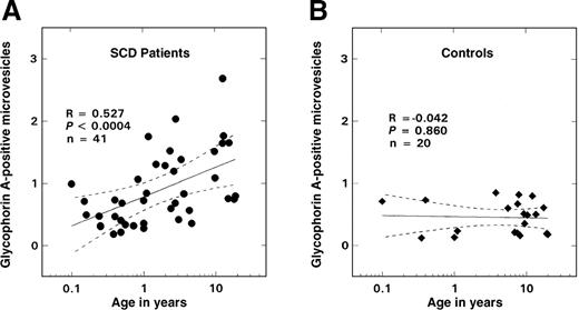 Fig. 2. Relationship between glycophorin-A–positive microvesicles and age. / The solid lines represent the linear-regression fit to the data, while the dotted lines represent the 99% confidence interval curves. (A) Patients with SS disease. (B) Controls.