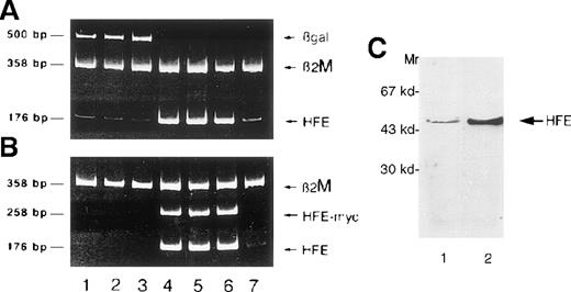 Fig. 2. Salmonella mediates HFE gene transfer in HC macrophages. / Expression of different genes in HC macrophages as detected by RT-PCR at 24 hours (lanes 1 and 4), 30 hours (lanes 2 and 5), and 48 hours (lanes 3 and 6) after Salmonella infection. Lanes 1 to 3, macrophages transfected with βgal; lanes 4 to 6, macrophages transfected with HFE; lane 7, noninfected HC macrophages. The same cDNA preparations were divided and amplified in duplicate test tubes with primers for either HFE and βgal (A) or HFE and HFE/c-myc (B), using β2M primers as an internal control for each reaction. The presence of the transgene is demonstrated by the detection of HFE/c-myc RNA. (C) Western blot of proteins from infected cells. Proteins (30 μg) from cell homogenates were separated by SDS-PAGE, blotted, and analyzed by Western blot using the anti-HFE polyclonal antibody. A significant increase of HFE expression was detected in cells infected with Salmonella carrying the pCMV-HFE plasmid (lane 2) compared with those infected with the pCMV-βgal plasmid (lane 1).