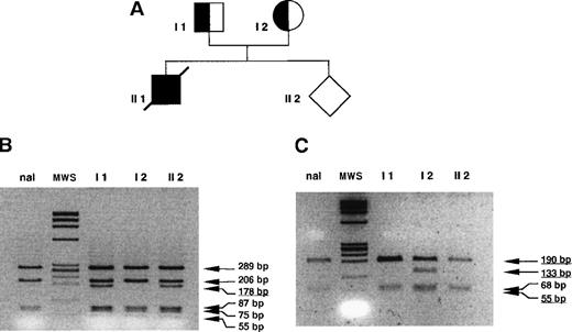 Fig. 2. PCR digestion analysis in family A. / DNA was prepared from peripheral blood for patients I 1 and I 2. Patient II 1 died in the perinatal period and was not available for the study. For the fetus (II 2), DNA was obtained from CVS. “nal” indicates normal control sample, MWS (molecular weight standard) = ΦX174 RF/HaeIII fragments. (A) Pedigree of family A. (B) PCR digestion of exon 3. Amplification of exons 2, 3, and 4 with the 1838 F and 2549 R set of primers was followed by digestion with DdeI (normal fragment 206 bp, mutants fragments 178 and 28 bp). Patients I 1 and II 2 are heterozygous for the mutation; patient I 2 is normal. (B) PCR digestion of exon 1. Amplification with the 520 F and 776 R set of primers followed by digestion with MwoI (normal fragment 190 bp, mutant fragments 133 and 56 bp). Patients I 1 and II 2 are normal, and patient I 2 is heterozygous for the mutation del 86-87.