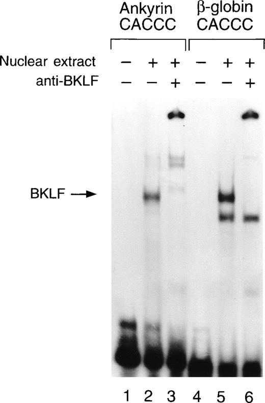 Fig. 8. Electrophoretic mobility shift assays of the footprinted CACCC site of the human ankyrin-1 gene promoter. / Gel mobility shift assays using oligonucleotides corresponding to the ankyrin-1 promoter footprinted CACCC site or a control β-globin CACCC site and nuclear extracts from COS cells transfected with a BKLF cDNA expression plasmid. BKLF antibody was added to the reaction mixtures where indicated.