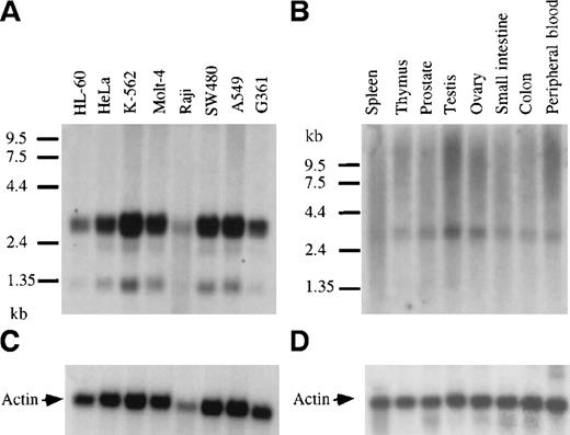 Fig. 4. Northern blot analysis and expression of GRAP mRNA in tumor cell lines and normal human tissues. / Northern blots containing 2.5 μg human polyA+RNA extracted from cancer cell lines or normal human tissues (panels A and B, respectively). Blots were hybridized with GRAP sequences. RNA size markers are shown on the left. Panels A and B correspond to blots. Panels C and D correspond to β-actin controls.