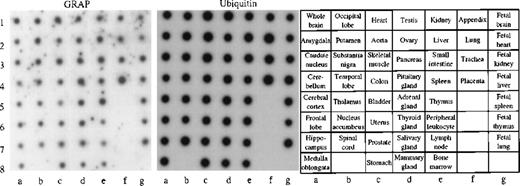 Fig. 5. Human RNA master dot blot. / The human RNA dot blot contains polyA+ RNA extracted from 50 different human tissues. The dot blot was hybridized with GRAP sequences. As a control, the same dot blot was hybridized with ubiquitin cDNA sequences (middle panel). The dot blot diagram is shown on the right panel.