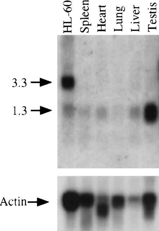 Fig. 7. Northern blot analysis and expression of GRAP mRNA in mouse tissues and HL-60 cells. / The upper panel shows the expression of GRAP in various mouse tissues. Total RNA from human promyelocytic cells (HL-60) is used as a positive control. RNA size markers are shown on the left. The lower panel shows the same blot hybridized to β actin sequences.