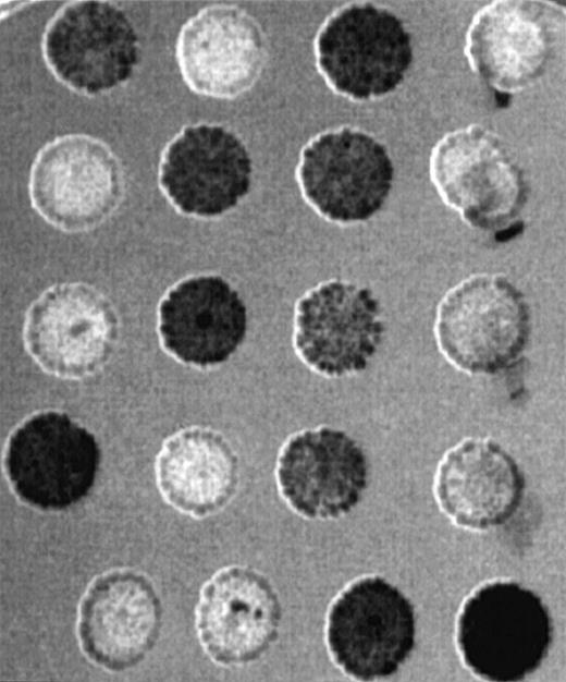 Fig. 8. Glycogen accumulation of wild-type and mutant yeast cells with a disrupted GRAP homologue. / Five tetrads dissected from heterozygous diploids for thegrhδ1::URA3 allele were patched on the YED-2% glucose plate, incubated at 30°C overnight, and stained with iodine vapor. Dark-stained patches contain cells positive for glycogen accumulation as well as the URA3 marker (data not shown).