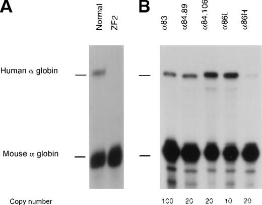 Fig. 3. Expression studies of cDH2. / Nuclease protection assays to analyze human -globin gene expression in (A) the abnormal interspecific hybrid (ZF2) and (B) adult peripheral blood from lines of transgenic mice carrying the cDH2 construct. Two samples from different individuals from line α84 are shown.