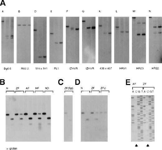 Fig. 4. Analysis of the pattern of methylation along the −ZF chromosome. / (A) CpG islands (A-N, see also Figure 1) were analyzed with a combination of enzymes and probes, which were previously described.253 In each panel, the left-hand lane is the chosen digest (eg, BglII) using DNA from the peripheral blood of an unaffected individual. The middle lane represents a double digest incorporating a methylation-sensitive enzyme (eg,BglII/SacII) using DNA from the peripheral blood of an unaffected individual. The third lane represents the same double digest (eg, BglII/SacII) using DNA from the peripheral blood of Z.F. The presence of 2 variably sized bands using IZHVR reflects the 2 different VNTR alleles detected with this probe. (B) Analysis of the CpG islands (H and I) associated with the α-globin genes using DNA from peripheral blood. In each case the left-hand lane is aPstI digest, and the right-hand lane is aPstI/EagI digest. (Only EagI cuts unmethylated sites.) N indicates an unaffected individual; ZF, the propositus; AF, the unaffected father; and HF, the affected mother. ND is a patient in whom an α gene was inactivated by a nondeletional form of α-thalassemia, demonstrating that such mutations do not alter the pattern of methylation. Note that both CpG islands (H and I) are examined in this assay. The different signal intensities of uncut DNA (methylated) to cut DNA (unmethylated) in Z.F. (αα/α−ZF) and H.F. (ααα/α−ZF) is explained by their different genotypes. Only the α−ZF chromosome is methylated at CpG island H. (C) Analysis of DNA from a sample of semen from Z.F. (D) Analysis of the CpG islands (H and I) in EBV-transformed lymphocyte lines from an unaffected individual (N), Z.F., and a MEL16 hybrid containing only the abnormal copy of chromosome 16 (ZF2). (E) Bisulphite modified sequence analysis of DNA from the peripheral blood of the propositus (ZF) and his unaffected father (AF). During bisulphite treatment of DNA, unmethylated cytosines were converted to uracil and subsequently PCR-amplified as thymidine. Methylated cytosines were resistant to this conversion and hence were amplified as cytosine. Arrows indicate that whereas all cytosines were converted to thymidines in A.F., many remain unconverted (methylated) in Z.F. Note that only the cytosines on one allele in Z.F. are methylated.