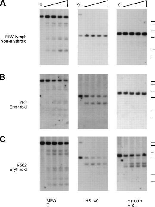 Fig. 5. Analysis of endonuclease sensitivity in the −ZF chromosome. / DNA from nuclei of (A) EBV lymphocytes, (B) an interspecific MEL hybrid containing the α−ZF chromosome (ZF2), and (C) the erythroid cell line K562. The DNA was incubated with increasing amounts of Hinf I (“Materials and methods”) and analyzed with probes around gene no. 6 (RA0.6, approximate coordinate 67 000), which encodes the ubiquitously expressed MPG gene, the α-globin regulatory element HS –40 (approximate coordinate 103 000), and the α-globin gene. Whereas the site associated with HS –40 is clearly present in ZF2, the sites are missing from the silenced α-globin promoter.