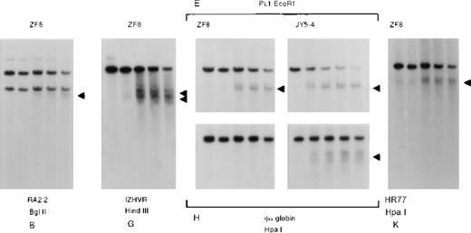Fig. 6. Analysis of DNase1 hypersensitive sites along the −ZF chromosome. / DNA from the nuclei of an interspecific MEL hybrid containing the α−ZF chromosome (ZF8) or a normal chromosome (JY5-4) using probes and enzymes that detect the hypersensitive sites at the CpG islands associated with the α2-globin promoter (H) and the surrounding CpG islands B, G, E, and K (see Figure1). Analysis of HSs at E and H in normal hybrids (JY5-4) and abnormal hybrids (ZF8) shows that although the constitutive site at E is sensitive in both, the HS at the silenced α promoter is insensitive.