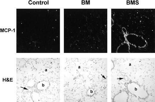 Fig. 4. MCP-1 mRNA transcription in the lung increases postirradiation and is potentiated by the presence of allogeneic T cells as assessed by in situ hybridization. / B10.BR recipient mice were preconditioned with TBI (day −1) and given C57BL/6 BM with 15 × 106 spleen cells (BMS) on the day of BMT (day 0). Lung tissues were harvested on day 3 post-BMT and cryosections hybridized with antisense digoxigenin-labeled riboprobe for MCP-1. Stained tissue (using the ELF-97 alkaline phosphatase substrate) was analyzed on an Olympus BX50 WI microscope under a 20 × objective lens with multiphoton confocal MRC-1024 imaging (tissue excited at 370 nm and emission collected at 515 nm). Light field images (stained by hematoxylin and eosin) were also photographed under a 20 × objective lens. Solid arrow indicates pulmonary arteriole; a, alveolar duct; b, bronchiole. Note the increased staining of vessel endothelium, bronchiolar epithelium, and alveolar cells in the BMS group.