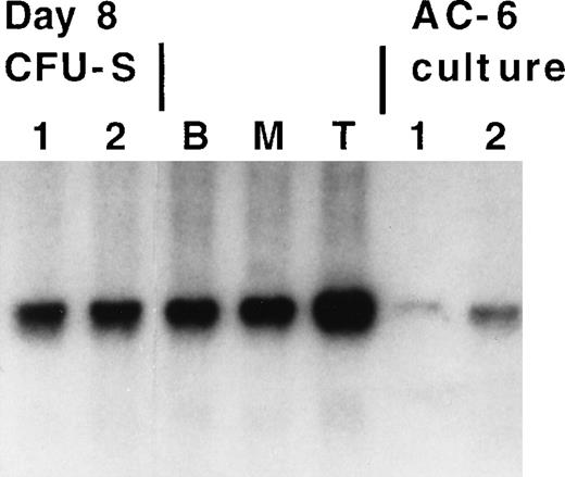 Fig. 11. Donor (Ly-5.2+) bone marrow cells contain integrated provirus based on Southern analysis. / Clonal assays to determine the number of proviral integrants per cell were done on isolated day 8 CFU-S colonies and from single stem cells FACS-sorted onto a stromal feeder layer (AC-6) that supports cell growth and expansion so that sufficient amounts of DNA could be isolated for analysis. B, T, and myeloid cell populations were purified by magnetic bead enrichment as described previously. The Southern blot was probed with a randomly primed GFP fragment.