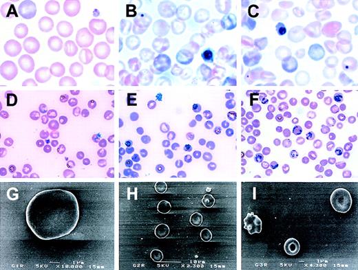 Fig. 5. Peripheral blood analysis of rescued GATA-1.05mice. / Blood samples were obtained from 5-week-old mice. While peripheral blood from a G1R line No. 782 mouse (A) contains normal red blood cells, the peripheral blood from G2R line No. 620 (B) and G3R line No. 390 (C) contains nucleated red blood cells. Reticulocytosis is evident in G2R (E) and G3R (F) but not in G1R (D). (G-I) Scanning electron microscopy of peripheral red blood cells. Anisocytosis is observed in G3R (I). Original magnifications in panels G, H, and I are × 10 000, × 2300, and × 4300, respectively.
