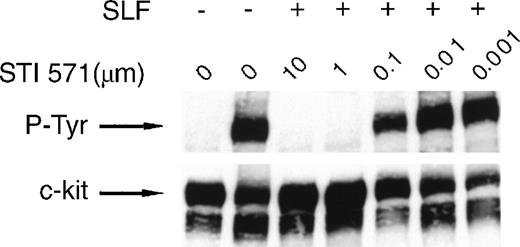 Fig. 1. STI 571 inhibits Steel factor (SLF)–dependent phosphorylation of c-kit. / Serum was withheld from M-07e cells overnight before they were pretreated with various concentrations of STI 571 for 90 minutes. Cells were then treated with vehicle (phosphate-buffered saline) or SLF (final concentration, 200 ng/mL) for 15 minutes. Whole cell lysates were immunoblotted by using an antiphosphotyrosine (anti-P-Tyr) antibody. The membrane was stripped and reprobed with a monoclonal antibody specific for human c-kit. The arrow indicates the position of the 145-kd isoform of c-kit. Representative results from 1 of 8 independent experiments are shown.