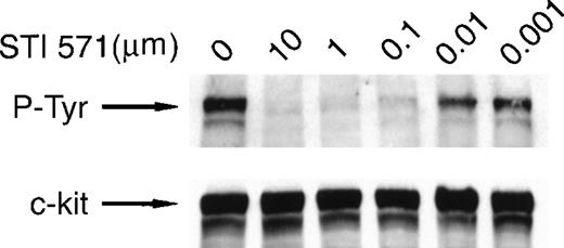 Fig. 2. STI 571 inhibits autophosphorylation of an activated mutant form of c-kit. / HMC-1 cells were treated with various concentrations of STI 571 for 90 minutes. Whole cell lysates were prepared and immunoblotted with an anti-P-Tyr monoclonal antibody. The membrane was stripped and reprobed with a monoclonal antibody specific for human c-kit. The arrow indicates the position of the 145-kd isoform of c-kit. Representative results from 1 of 8 independent experiments are shown.