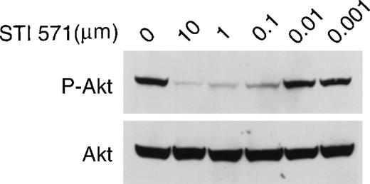 Fig. 7. STI 571 inhibits c-kit–dependent activation of Akt in HMC-1 cells. / Whole cell lysates of M-07e cells were prepared and immunoblotted with a polyclonal antibody specific for Akt protein that had been activated by phosphorylation of serine 473. The membrane was stripped and reprobed with an antibody to total Akt. Representative results from 1 of 8 independent experiments are shown.