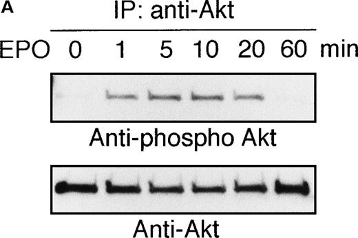 Fig. 1. EPO induces serine phosphorylation of Akt protein in time- and dose-dependent fashions in UT-7/EPO cells. / EPO was removed from UT-7/EPO cells for 24 hours. The cells were then stimulated with EPO (10 U/mL) for the periods indicated (A), or with increasing concentrations of EPO (0.01-100 U/mL) for 10 minutes (B). After solubilization, cell lysates were immunoprecipitated with protein G-conjugated anti-Akt antibody. Immunoprecipitates were eluted with buffer containing SDS and resolved by 10% SDS-PAGE. Proteins were transferred onto a PVDF membrane. Upper panel: immunoblotting with antiphospho Akt antibody. Lower panel: the blot was reprobed with anti-Akt serum to confirm equal loading of protein.
