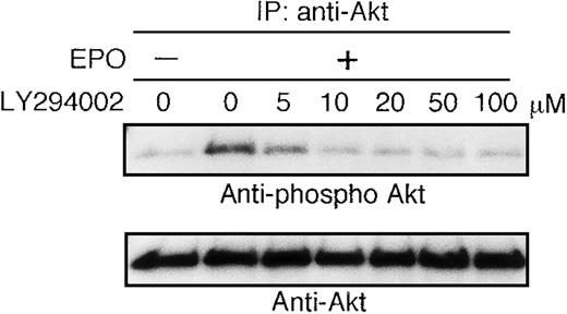 Fig. 2. Activation of AKT by EPO is absolutely dependent on PI3K activity. / EPO was removed from UT-7/EPO cells for 24 hours. The cells were pretreated with increasing concentrations of LY294002 (10-100 μmol/L) and then stimulated with EPO (10 U/mL) for 10 minutes. After solubilization, cell lysates were immunoprecipitated with protein G-conjugated anti-Akt antibody. Immunoprecipitates were eluted with buffer containing SDS and resolved by 10% SDS-PAGE. Proteins were transferred onto a PVDF membrane. Upper panel: immunoblotting with antiphospho Akt antibody. Lower panel: the blot was reprobed with anti-Akt serum to confirm equal loading of protein.