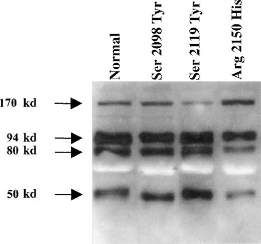 Fig. 3. Western blot analysis of recombinant normal and purified fVIII. / Partially purified normal and mutant rfVIII molecules were immunoprecipitated by using the human monoclonal antibody BO2C11 bound on protein A Sepharose and analyzed by SDS-PAGE followed by Western blotting. Mouse anti-fVIII moab 12 and F14A12 were used to detect fVIII fragments.