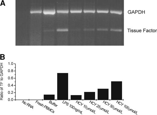 Fig. 2. Tissue factor and GAPDH message expression after treatment of PBMC with homocysteine or LPS by semiquantitative RT-PCR. / (A) Gel. (B) Results of densitometric analysis of the gel, expressing tissue factor message as a ratio to that of the message for the housekeeping gene, GAPDH. HCY, homocysteine. In the lanes marked buffer, LPS, and HCY, PBMCs were incubated with the respective reagent for 4 hours before RNA was extracted. In the lane marked fresh PBMCs, RNA was extracted immediately after isolation of the monocytes.