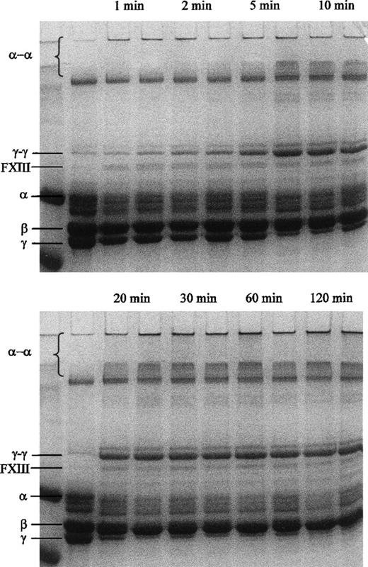 Fig. 6. Formation of fibrin - and γ-chain cross-links as analyzed by SDS-PAGE. / First lane of each gel shows a molecular weight marker (102.0 and 81.0 kd) and second lane shows the fibrinogen preparation before incubation with thrombin and FXIII. Following lanes show pairwise incubations of 6.1 μmol/L fibrinogen with 0.5 U/mL human thrombin and 0.1 μmol/L FXIII 34Val (left-hand lanes) or FXIII 34Leu (right-hand lanes) for the times as indicated in the figure.