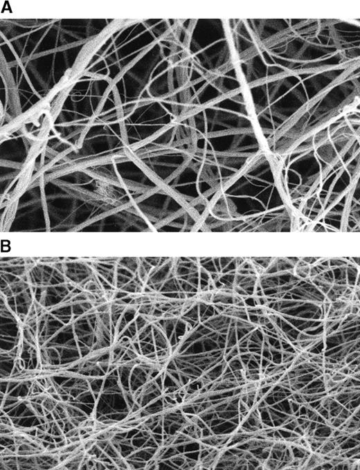 Fig. 7. Scanning electron micrographs of fibrin clots prepared from plasma samples of subjects homozygous for FXIII 34Val and FXIII 34Leu. / Clots were prepared from plasma samples from subjects homozygous for FXIII 34Val (A) and homozygous for FXIII 34Leu (B). Magnification is × 5000 for both micrographs. The electron micrographs are representative of 6 samples scanned in 6 different areas showing similar results.