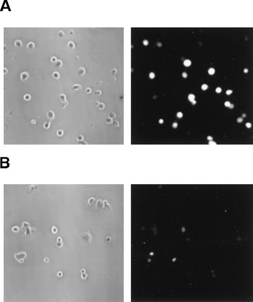 Fig. 2. Extracellular ATP induces permeabilization in DCs. / Phase contrast microscopy (left panels) and the respective fluorescence microscopy (right panels) of DCs incubated for 15 minutes at 37°C with lucifer yellow (0.5 mg/mL) either with (A) or without (B) 5 mmol/L ATP. It is clear that ATP treatment enhanced the entrance of the fluorescence dye into the cells. (Magnification, 320×.)