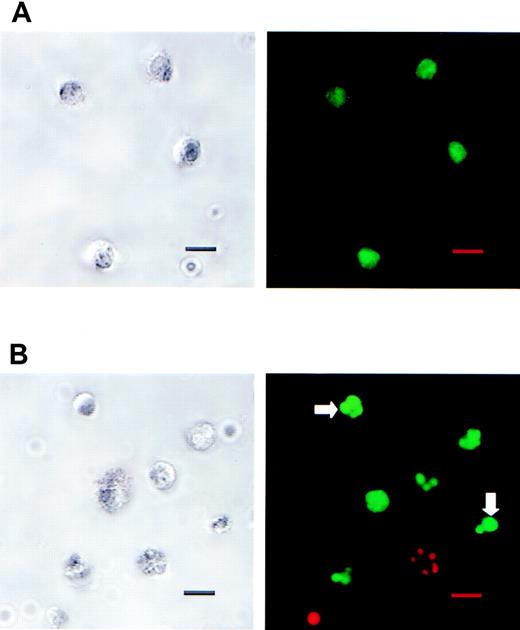 Fig. 11. ATP treatment induces morphologic changes in DCs compatible with apoptosis. / DC suspension was incubated with ATP (5 mmol/L) for 30 minutes at 37°C, washed twice with PBS, and incubated additionally for 6 hours in complete RPMI 1640 medium. DCs were incubated immediately before the analyses with acridine orange (5 μg/mL) and propidium iodide (10 μmol/L) to determine nuclear morphology and cell integrity, respectively. The DC apoptotic phenotype was ascertained by laser scanning confocal microscopy. The right panels represent the images of fluorescence data and the left ones represent the corresponding transmitted images. (A) Control DCs were viable, presenting green-labeled round nuclei. (B) The ATP-treated DC suspension presented cells with features associated with different stages of apoptosis: chromatin condensation (increased nuclei fluorescence), fragmented nuclei and apoptotic bodies (arrows), and secondary necrosis (fragmented nuclei labeled red with propidium iodide). Bar: 10 μm.