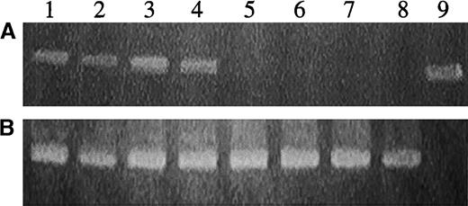 Fig. 7. Detection of the MGirL22Y genome in DNA from human hematopoietic cells derived from secondary progenitors cultured from a NOD/SCID recipient of CD34+ cells transduced with RD114-pseudotyped vector particles. / (A) PCR analysis with primers specific for EGFP sequences. (B) PCR analysis with the internal control β-actin primers. Lanes 1 to 8 represent analysis of DNA from individual hematopoietic colonies. Lane 9 represents analysis of plasmid DNA encoding EGFP.