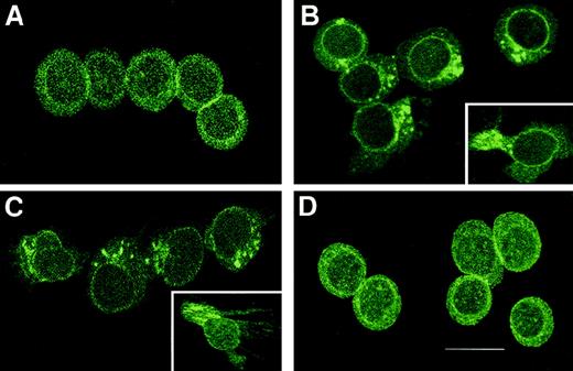 Fig. 9. Assessment of cellular distribution of CXCR3 after stimulation. / (A) CXCR3 distribution on GM-CSF–stimulated CD34+hematopoietic progenitors before the chemotaxis assay. After stimulation, the CXCR3 receptors redistributed to the leading edge of the polarized migrating GM-CSF–stimulated CD34+hematopoietic progenitors, toward γIP-10 (B), Mig (C), or SDF-1α (D). The CD34+ cells were stimulated with GM-CSF for 36 hours and then subjected to the chemotaxis assay. The migrating cells were collected and stained and then photographed under epifluorescence conditions (original magnification ×1200; bar, 12 μm).