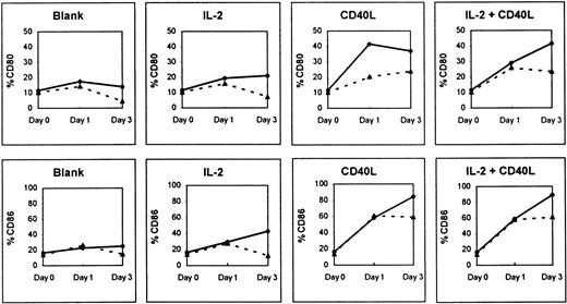 Fig. 5. Effect of culture with and without huCD40LT and IL-2 on CD80 and CD86 expression. / Expression was tested on peripheral blood B cells of patients with myeloma (▴; n = 9) and normal controls (⋄; n = 5).