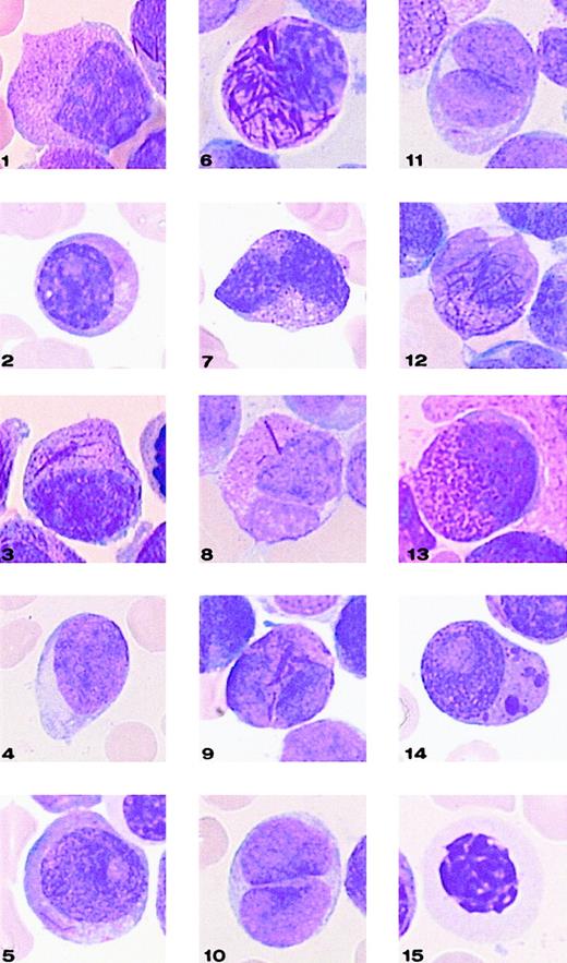 Fig. 2. Representative cells from each cell category of the classification system. / Bone marrow smears were stained with May-Grünwald-Giemsa and registered at a 1000-fold magnification on a Leica-ICG system database.
