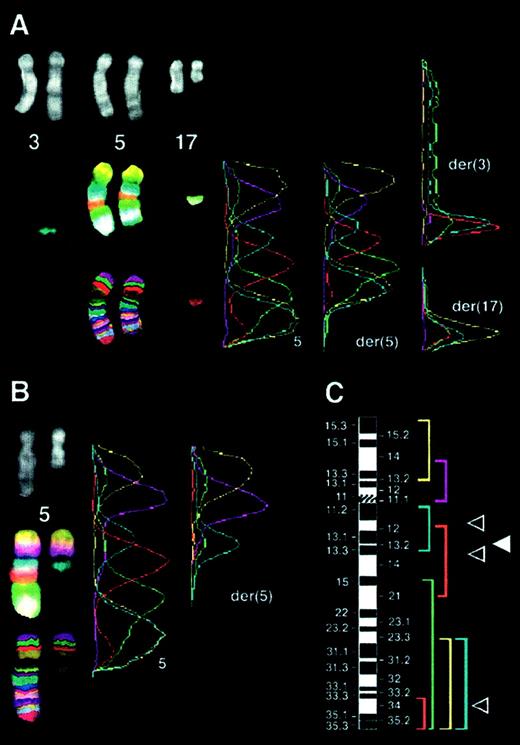 Fig. 5. Multicolor banding of chromosome 5 in the t(5;17) cases. / (A) Case 54: insertion of the 5q13 band into band 3q26 and translocation of segment 5q34-qter to band 17q21. Figure shows the translocation of 17q to the der(5q). Left panel: top, DAPI filter; middle, compilation of captures with each filter excluding the DAPI one; bottom, multicolor banding specific for chromosome 5 material obtained after image processing. Right panel: profile of fluorescence intensities along the chromosomal axes. Peaks on der(3) and der(17) are derived from chromosome 5 material. (B) Case 55: localization of the 5q breakpoint to 5q13. Analysis as described in panel A. (C) Location and labeling of chromosome 5 region–specific partial chromosome paints; breakpoints in case 54 (▵) and in case 55 (▴) are shown.
