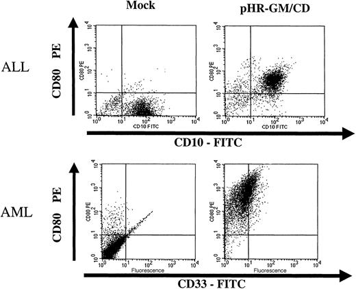 Fig. 6. Transduction of fresh acute lymphoblastic leukemia (ALL) cells and acute myeloid leukemia (AML) cells with pHR-GM/CD. / The panels on the left represent the nontransduced (mock-transduced) cells, and the panels on the right show the cells transduced with the pHR-GM/CD vector. Dot-plot analysis of the double staining for lineage markers (fluorescein isothiocyanate–conjugated anti-CD10 and anti-CD33) and transgene expression (phosphatidylethanolamine-conjugated anti-CD80) is shown. Isotype nonspecific control antibodies were used to set up the background levels.