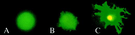 Fig. 2. Fluorescence microscopy of transduced cells. / Monocytes were cultivated with GM-CSF or with GM-CSF and IL-4 to generate Mo macrophages (A) and DCs (B and C), respectively. On day 7, cells were transduced with HIV-1ΔEN V3 (A and B) or with HIV-1ΔEN (C) at a MOI of 5 and incubated further in cyokine(s) supplemented medium. On day 5 after transduction, cells were analyzed by fluorescence microscopy. DCs were either analyzed directly (immature DCs; B) or treated with LPS to generate mature DCs (C) before analysis by fluorescence microscopy.