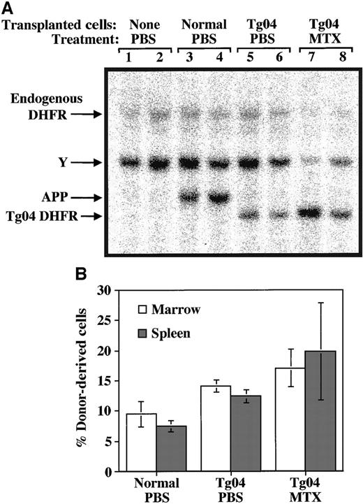 Fig. 4. Engraftment of donor-derived cells in bone marrow and spleen of primary BMT recipients preconditioned with 1 Gy TBI. / Surviving animals (depicted in Figure 3) were killed 120 days after transplantation. Genomic DNA samples isolated from bone marrow and spleen were subjected to quantitative Southern analysis as described in “Materials and methods.” (A) Representative Southern image of selected spleen samples. A DHFR probe was used to quantitate total DNA (En DHFR) and donor-derived DHFR transgenic DNA (Tg04 DHFR). An APP probe was used to quantitate donor-derived normal cells (APP), and a Y probe was used to quantitate the percentage of host cells (Y). (B) Levels of engrafted donor-derived cells. Signals from the Southern image were quantified using a PhosphorImager. Ratios of APP/En DHFR and Tg DHFR/En DHFR were used to calculate the percentage of donor-derived normal and Tg04 cells, respectively, from a standard curve. Values are presented as mean ± SD of 5 to 9 samples.