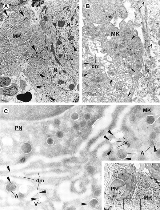 Fig. 2. Views of altered Mks and results with labeling for P-selectin. / (A) Myeloperoxidase-positive PMN granules (arrowheads) are free in the cytoplasm of an altered Mk (original magnification ×3135). (B) Myelofibrosis (f) develops at contact with an altered Mk. The Mk has a dysmorphic and heterogenous demarcation membrane system (dm). Some well-preserved α granules are scattered in the cytoplasm (arrows), as are swollen and disrupted α granules (arrowheads) (original magnification ×11 700). (C) Results of immunogold labeling for P-selectin done on frozen thin section from a TPO mouse Mk. P-selectin (arrowheads) is detected in the vicinity of a PMN cell (PN) entering the Mk demarcation membrane system (dm) by means of emperipolesis. Labeling appears in the α-granular (A) membrane, in cytoplasmic vacuolar structures (V), and along some demarcation membranes (dm) (original magnification ×38 750). The inset shows a lower-magnification view of the PMN cell (PN) in the Mk (original magnification ×12 400).