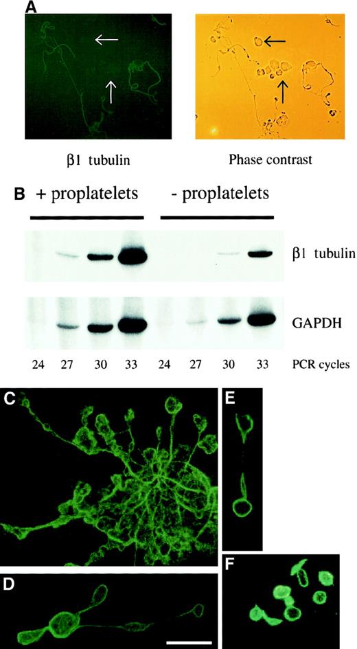 Fig. 4. β1 tubulin expression is associated with megakaryocytes forming proplatelets. / (A) Immunofluorescence analysis of primary wild-type fetal liver cell cultures performed with β1 tubulin-specific antiserum (left). Cells not forming proplatelets (arrows; including other blood cell lineages and immature megakaryocytes) are not stained. A phase-contrast image of the same microscopic field is shown on the right. (B) Semiquantitative RT-PCR analysis of β1 tubulin mRNA expressed in wild-type megakaryocytic colonies forming (+) or not forming (−) proplatelets, using primers specific for β1 tubulin and GAPDH (loading control). The numbers of PCR cycles are indicated. (C-F) Immunofluorescence analysis of individual cultured megakaryocytes (C), proplatelet fragments (D, E), and blood platelets (F) with β1 tubulin-specific antiserum. Scale bar, 5 μm.