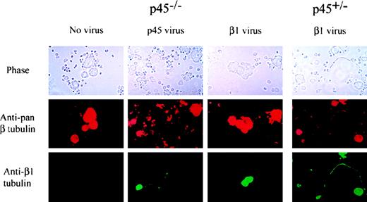 Fig. 6. β1 tubulin expression in p45 NF-E2−/−megakaryocytes does not by itself induce the formation of proplatelets. / Wild-type (right) or p45 NF-E2−/− Lin− cells (left) were infected with retroviruses encoding p45 NF-E2 or β1 tubulin or were not infected as indicated on the top. After 3 days of culture, immunofluorescence was performed using β1 tubulin-specific antiserum (bottom) or a monoclonal antibody reactive against all β tubulin isoforms (middle). Phase-contrast images of the same microscopic field are shown for each case.