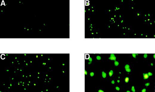 Fig. 2. HIV-1 gp120/160-induced HUVEC apoptosis as detected by TUNEL assay. / HUVEC grown in LSM were untreated (A) or treated with gp120 (1000 ng/mL) (B) or gp160 (1000 ng/mL) (C) for 10 hours; gp120-treated (1000 ng/mL) HUVEC at a higher magnification are represented in (D). Samples were analyzed for apoptosis using the TUNEL method. Green fluorescent cells represent apoptotic cells.
