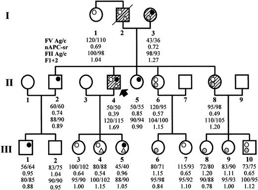 Fig. 1. Family pedigree and coagulation laboratory data. / The propositus is subject II4 (arrow). Open circle, FV Leiden (R506Q); gray circle, FV R2 (H1299R); closed circle, FV defect (Y1702C); open triangle, PT 20210G/A. Symptomatic family members are hatched. The numbers reported below each family member express the FV antigen and activity levels (normal range, 70%-130%), the normalized APC ratio (APC resistance is defined by an APC ratio less than 0.84), the PT antigen and activity levels (normal range, 75%-125% and 80%-120%, respectively), and the F1 + 2 values in nmol/L (normal range, 0.4-1.1 nmol/L), respectively.