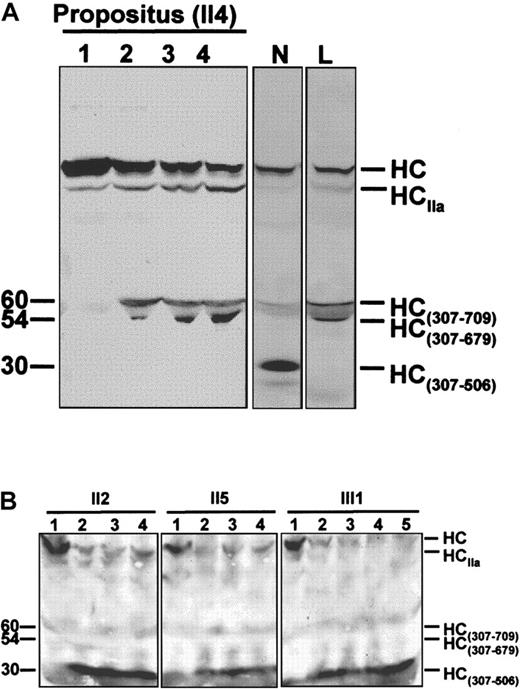 Fig. 4. Time courses of APC-mediated FVa inactivation. / (A) Time course of FVa inactivation in the FV R506Q/Y1702C doubly heterozygous propositus. The inactivation end-point patterns of normal (N) and R506Q (L) FVa are reported for comparison. In the normal control, the FV heavy chain (HC) is cleaved by APC at Arg506 and Arg306, resulting in a 30-kd immunoreactive fragment (HC307-506). In the FV R506Q homozygote, cleavage of the FV heavy chain does not generate the HC307-506fragment, and a 60/54-kd doublet (HC307-679/709) appears instead. The propositus' FV shows an inactivation pattern indistinguishable from that of the R506Q FV homozygote, which indicates that the Y1702C FV is not expressed in plasma. HCIIa is a shorted heavy chain of FVa, due to the prolonged exposure of FVa to the thrombin generated following clot formation and characterized by considerably lower cofactor activity. It suggests a potentially alternative method for FVa inactivation in FVR506Q individuals.5051 Lane 1, FVa in the presence of phospsholipid vesicles before adding APC; lanes 2 to 4, FVa 5, 10, and 20 minutes after the addition of APC. Molecular weights (kd) are reported on the left. (B) Time course of FVa inactivation in family members carrying the FV Y1702C mutation as a single heterozygous defect. The normal FVa inactivation pattern (presence of the 30-kd band and absence of the 60/54-kd doublet) indicates that the Y1702C FV molecules do not contribute to the altered FVa inactivation pattern (propositus, Figure 4A). Lane 1, FVa in the presence of phospholipid vesicles before adding APC; lanes 2 to 5, FVa 3, 5, 10, and 20 minutes after the addition of APC.