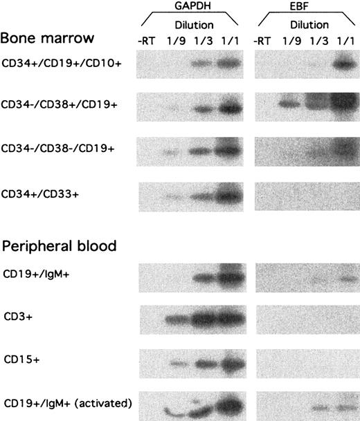 Fig. 4. hEBF is expressed during normal B-cell development. / RT-PCR analysis of sorted primary human cells from either bone marrow or peripheral blood, as indicated. GAPDH message was detected after 27 cycles of PCR, blotting of the resulting products to a nylon membrane, and hybridization to an internal oligonucleotide; whereas 32 cycles of PCR were performed before blotting and hybridization to detect EBF-encoding mRNA. −RT indicates that RNA preparations have been included in the reaction without prior cDNA synthesis.