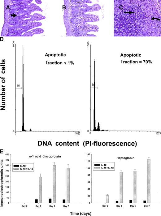 Fig. 2. Histopathology and serum acute-phase proteins. / (A) (B) Photomicrographs of small intestine from C57BL/6 control mice (panel A) and SCID mice (panel B) treated with IL-18 plus IL-12 and killed at 72 hours. The small intestinal villi are severely blunted with crypt hyperplasia with abundant apoptotic cells in the crypt epithelium (short arrow). H & E stain at 200 ×. (C) The spleen of a C57BL/6 mouse treated with IL-12 plus IL-18 mice shows atrophy of the lymphoid tissue with abundant apoptotic lymphocytes (long arrow) and reticuloendothelial hyperplasia within the marginal zone (curved arrow). H & E stain, 200 × magnification. (D) Nonadherent splenocytes (85% to 90% NK cells by FACS) from PBS-treated (left panel) or IL-18 plus IL-12–treated SCID mice (right panel) were harvested at 48 hours and analyzed for the presence of apoptotic cells via a flow-cytometric assay using propidium iodide staining.42Apoptotic nuclei appear within the hypodiploid region of the DNA histogram (M1) owing to the endonucleolytic cleavage of DNA. (E) SCID mice received daily injections of IL-18 plus IL-12 or IL-18 alone for 72 hours. Serum was harvested at the indicated time points and analyzed for the presence of α1-acid glycoprotein (right panel) and haptoglobin (left panel) via immunoelectrophoresis. These results represent the mean of duplicate samples ± SEM.