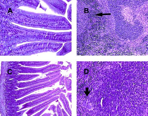Fig. 9. Photomicrographs of intestine and spleen from CD3ε transgenic and STAT1-deficient mice treated for 72 hours with IL-18 plus IL-12. / In contrast to the lesions seen in C57BL/6 control mice and SCID mice (Figure 2A-C), the small intestinal villi of both CDεTG mice (A) and STAT1−/− mice (C) are normal. The spleen from both the CD3εTG mice (B) and STAT1−/− mice (D) show normal lymphoid tissue (white pulp and increased extramedullary hematopoiesis in the red pulp, arrows). H & E stain, 200 × (panels A and D) or 100 × (panels B and C) magnification.