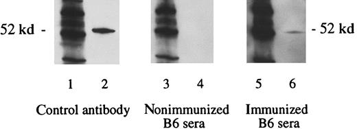 Fig. 11. Detection of WT1-specific antibodies in B6 mice immunized with the WT1-positive tumor cell line TRAMP-C. / Mice were inoculated twice at 2-week intervals by subcutaneous injection with WT1 overexpressing TRAMP-C cells. Three weeks after the final immunization, sera were obtained. Lanes 1, 3, and 5 show the molecular weight marker (MWM); lanes 2, 4, and 6 show the WT1 polypeptide WT N180. Primary antibodies used were WT180 in lane 2, sera of nonimmunized B6 mice in lane 4, and sera of B6 mice immunized with TRAMP-C tumor cells in lane 6.