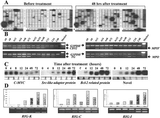 Fig. 1. The examples of 4 methods used to confirm ATRA-modulated genes in the differentiation of NB4 cells. / (A) A partial view of a cDNA array result by comparing the transcriptional expression pattern in untreated NB4 cells (left) with that in ATRA-treated NB4 cells (right). The signals of housekeeping genes appeared in the bottom as an internal control. (B) The results of semiquantitative RT-PCR. The up-regulation of CD52 and the down-regulation of myeloperoxidase seem to be protein synthesis–independent, while the up-regulation of transglutaminase and myeloid progenitor inhibitory factor was completely suppressed by the protein synthesis inhibitor cycloheximide. In the figure, A denotes ATRA; C, cycloheximide; and Ac, a combination of ATRA and cycloheximide. The number denotes hours after treatment. (C) The results of Northern blotting, with the lower panel showing the loading control (28s rRNA). (D) Relative mRNA levels of 3 novel genes (RIG-K, RIG-C, and RIG-I) were measured by semiquantitative RT-PCR and the Taq-man real-time quantitative PCR assay using the same samples. Data from theTaq-man analysis were normalized to mRNA concentrations according to the concentration of internal control actin and plotted relative to the level at time zero. The expression profiles of these genes, as measured by these 2 independent methods, were quite similar.